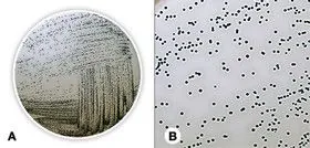 Agar Baird Parker (Bază), ISO 11133, ISO 6888, ISO 22718, 500 g, plastic — Carl Roth, cod X913.1