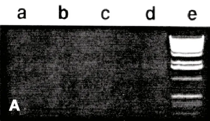 DNA AWAY®, gata de utilizare, pentru îndepărtarea contaminărilor cu ADN, 4 l, plastic — Carl Roth, cod X996.2